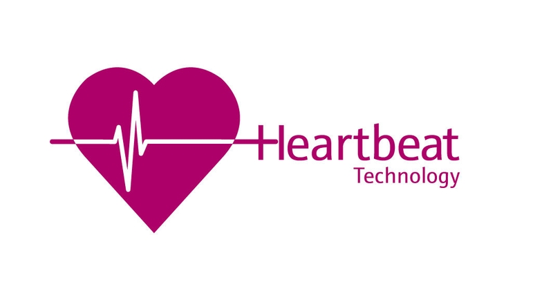 Heartbeat Technology心跳技术能够诊断、校验和监测测量点。